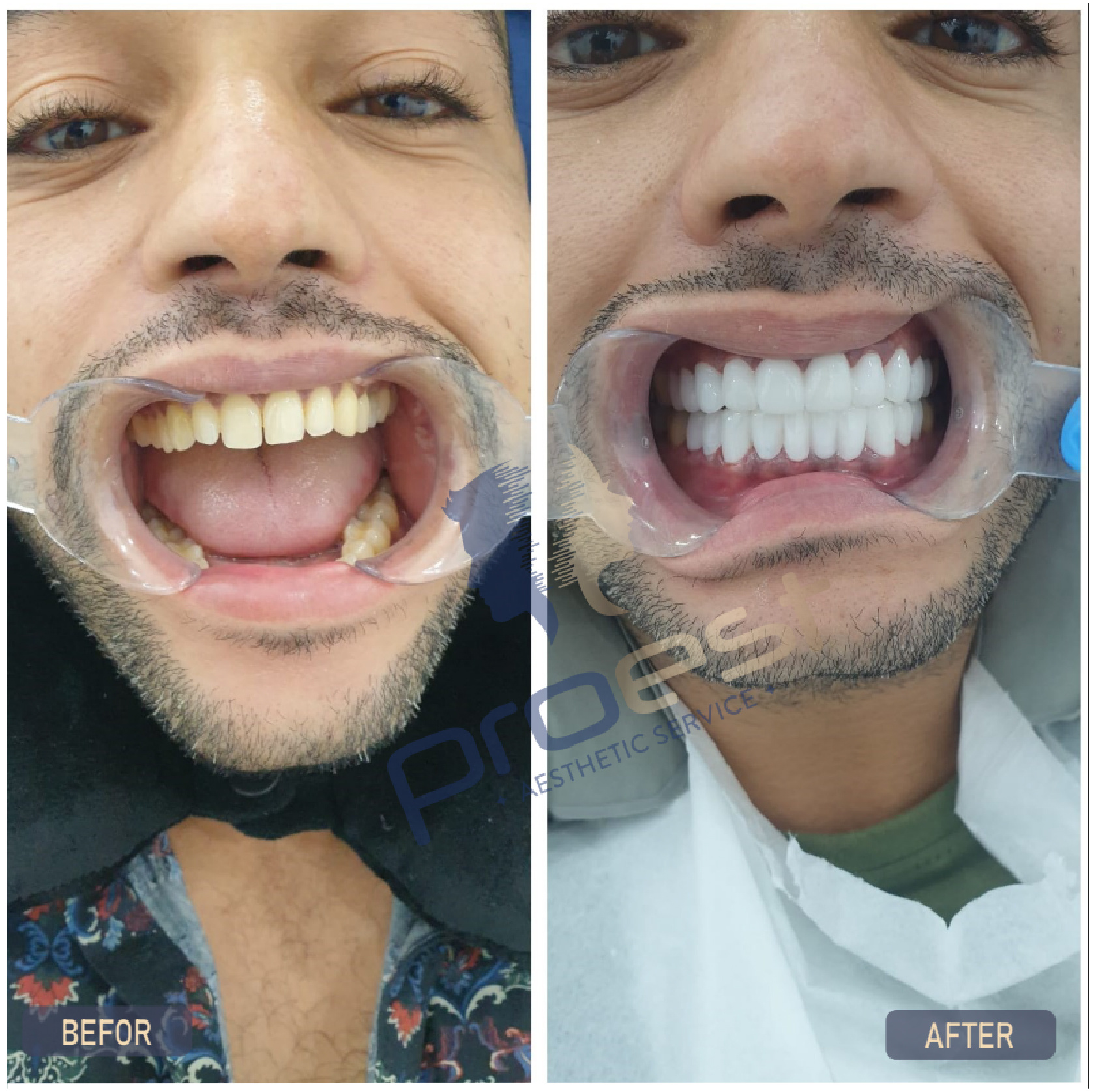 Estetica dentale